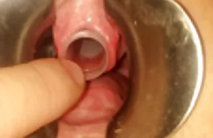 Gadis adegan dengan seks dengan wanita hamil tinju di Laut Hitam vagina.